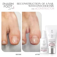 ערכה לשחזור ושיקום מבנה הציפורן | reCONSTRUCTOR | Pharm foot