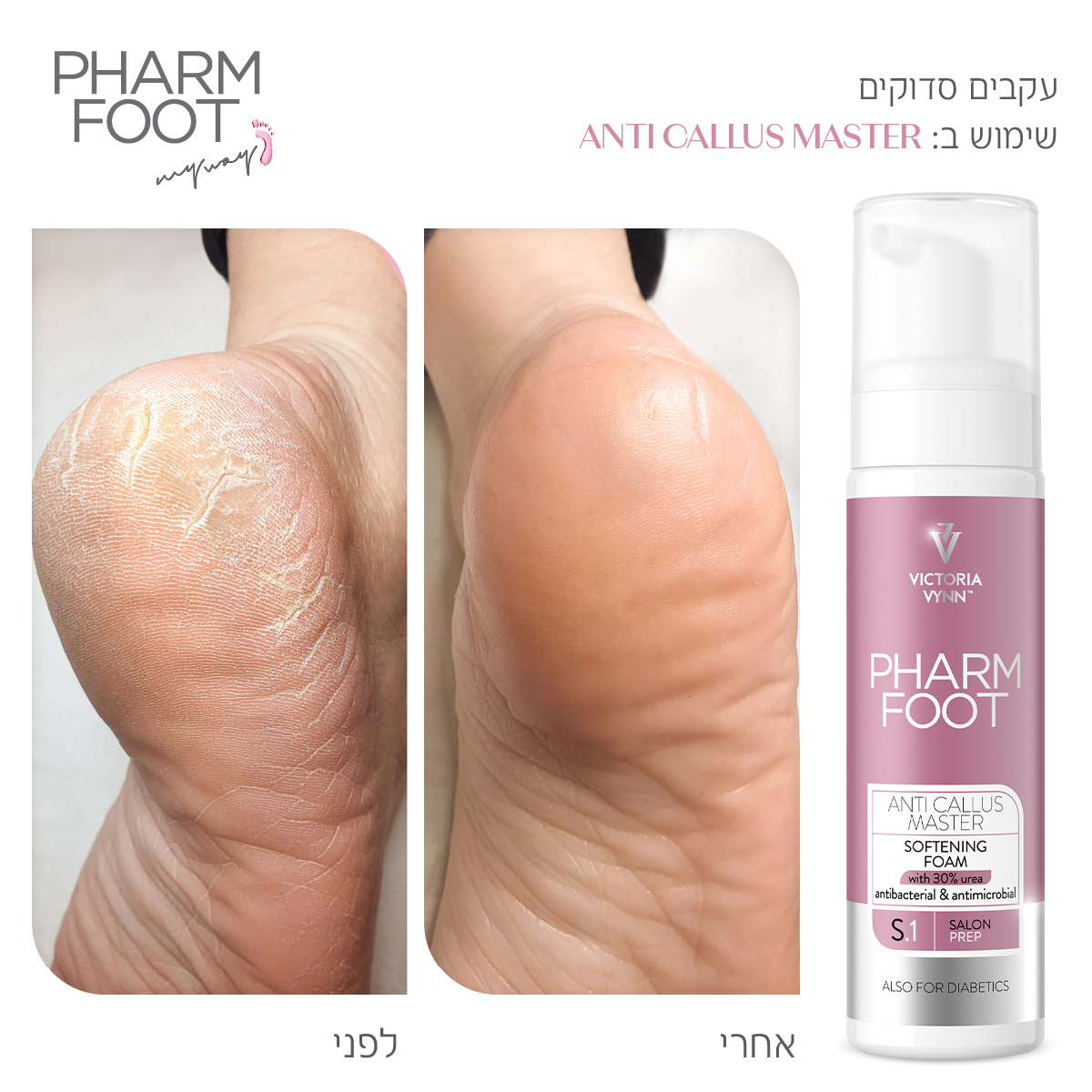 פארם פוט – Pharm Foot | מארז עור קשה