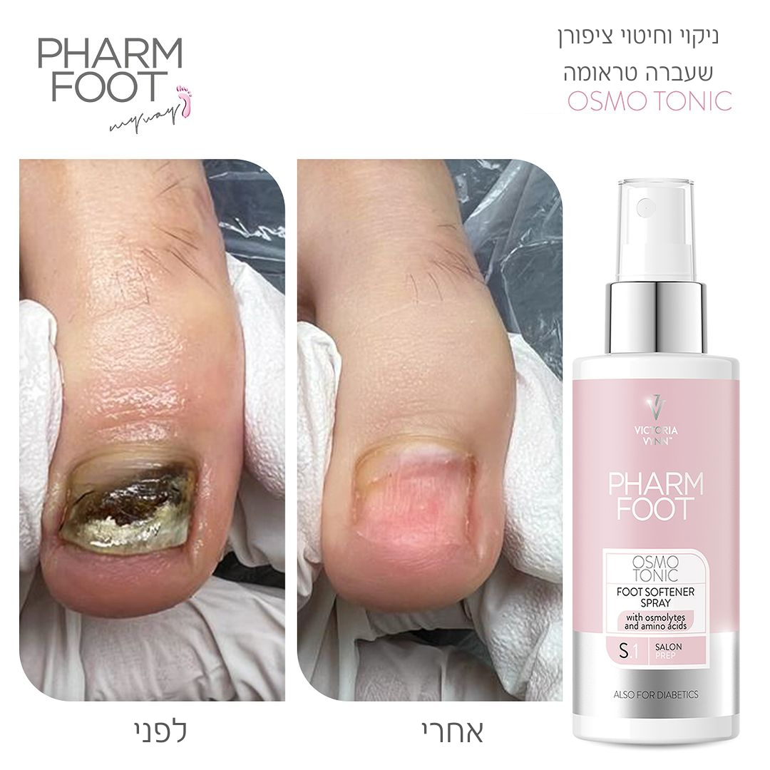 פארם פוט – Pharm Foot | מארז פטרת
