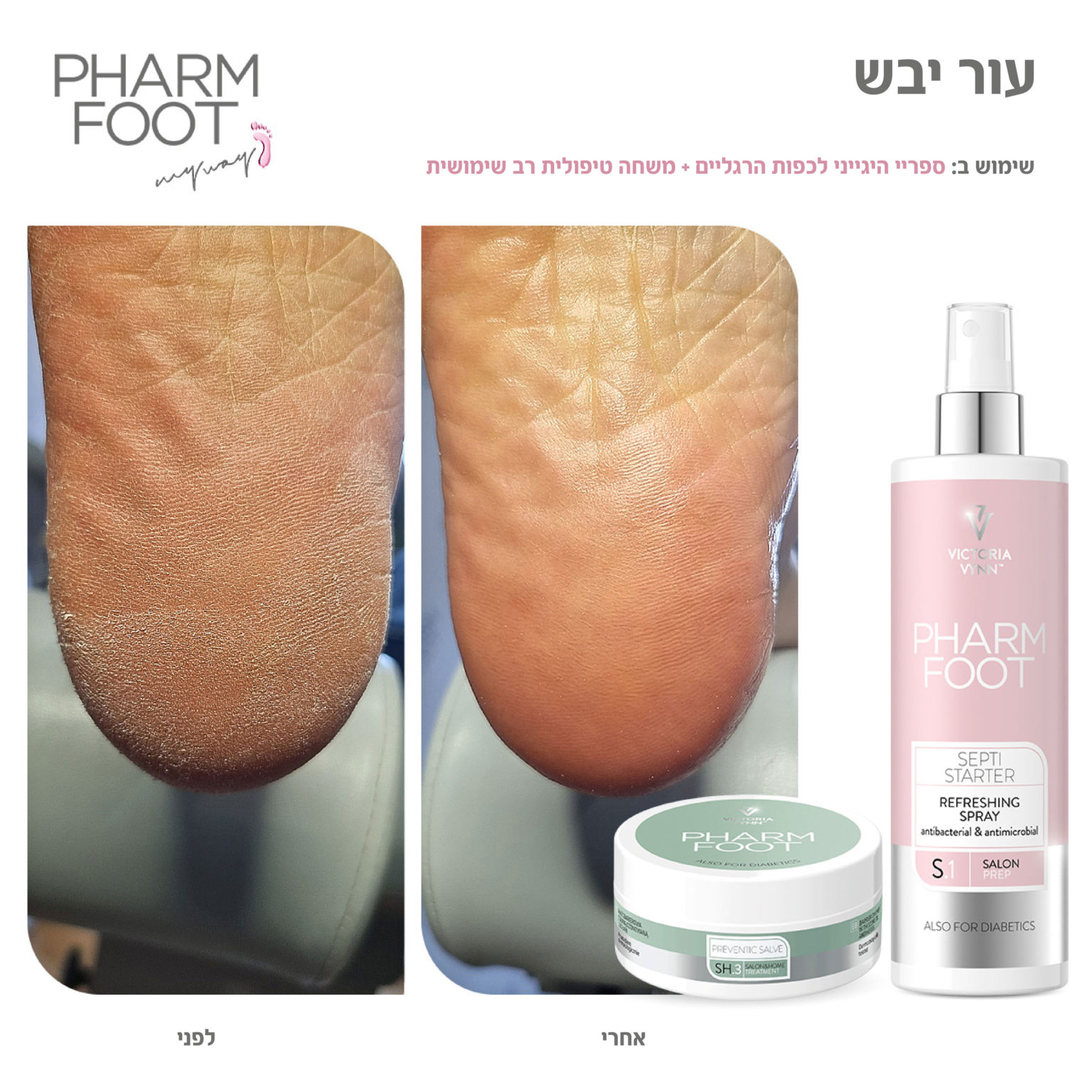 פארם פוט – Pharm Foot | מארז יבלות