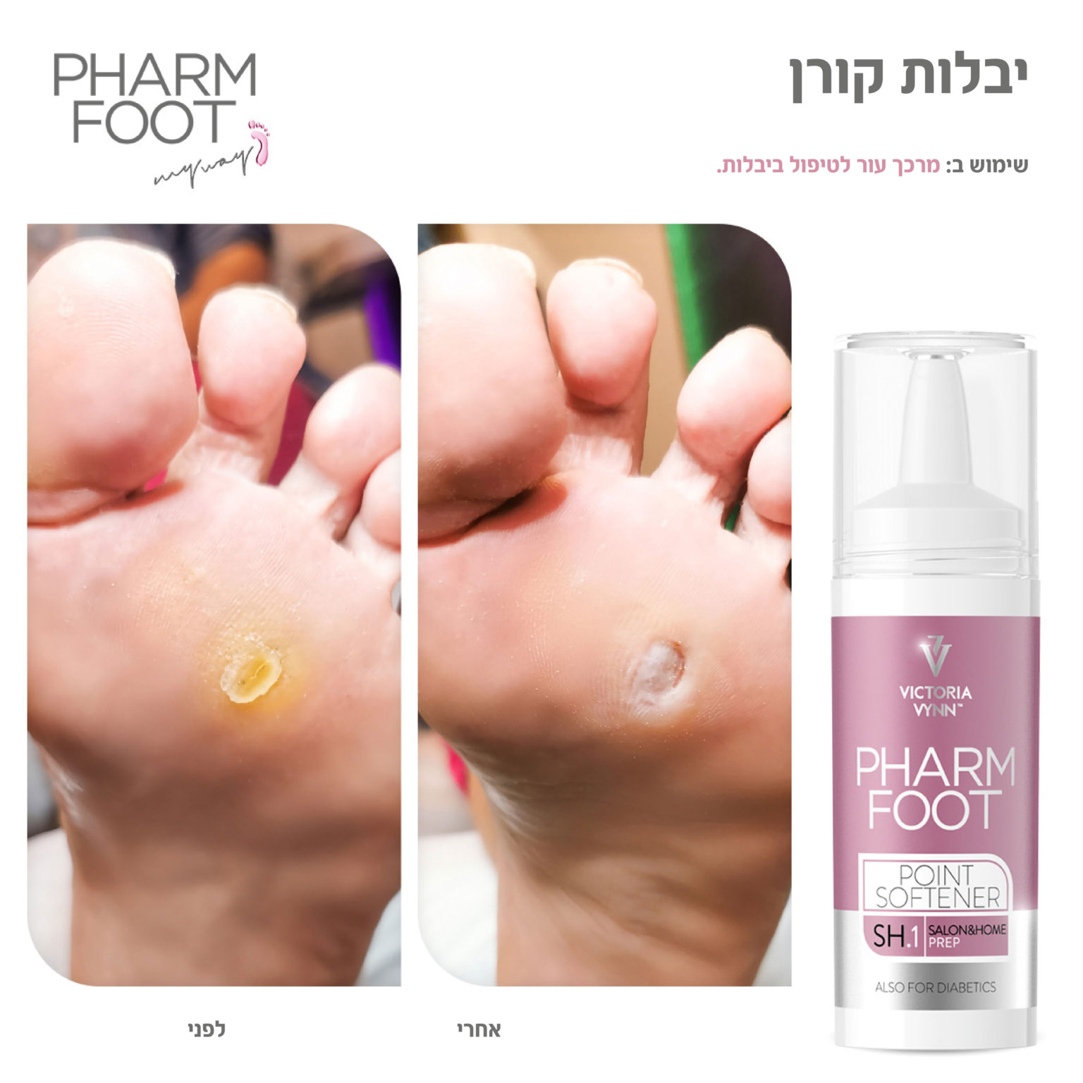 פארם פוט – Pharm Foot | מארז יבלות